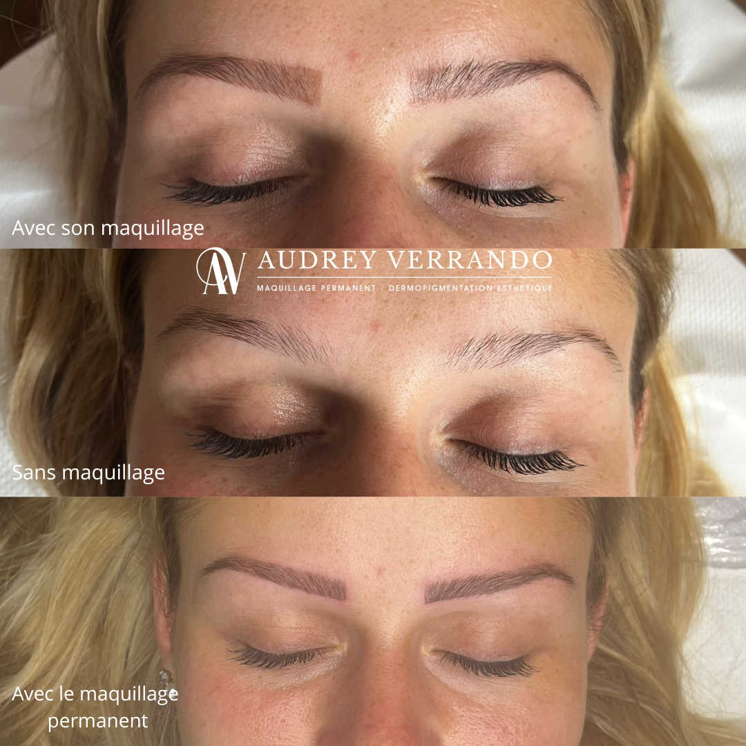 Avant/Aprés sourcils mixte