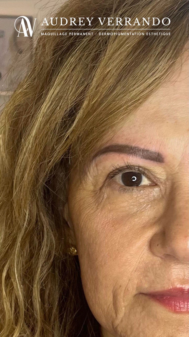 SOS Correction ancienne pigmentation 